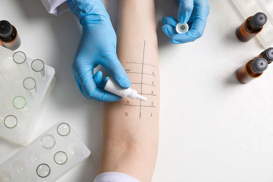 A doctor testing for type of allergies
