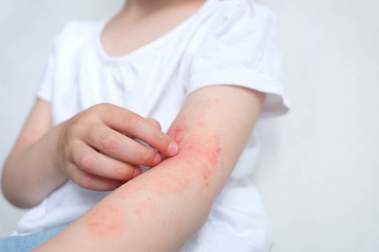A person suffering from a rare type of allergy
