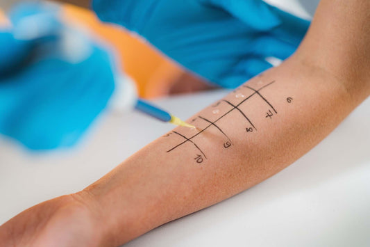 Allergy testing being done