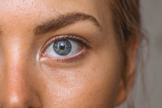 What Causes Eye Allergies?