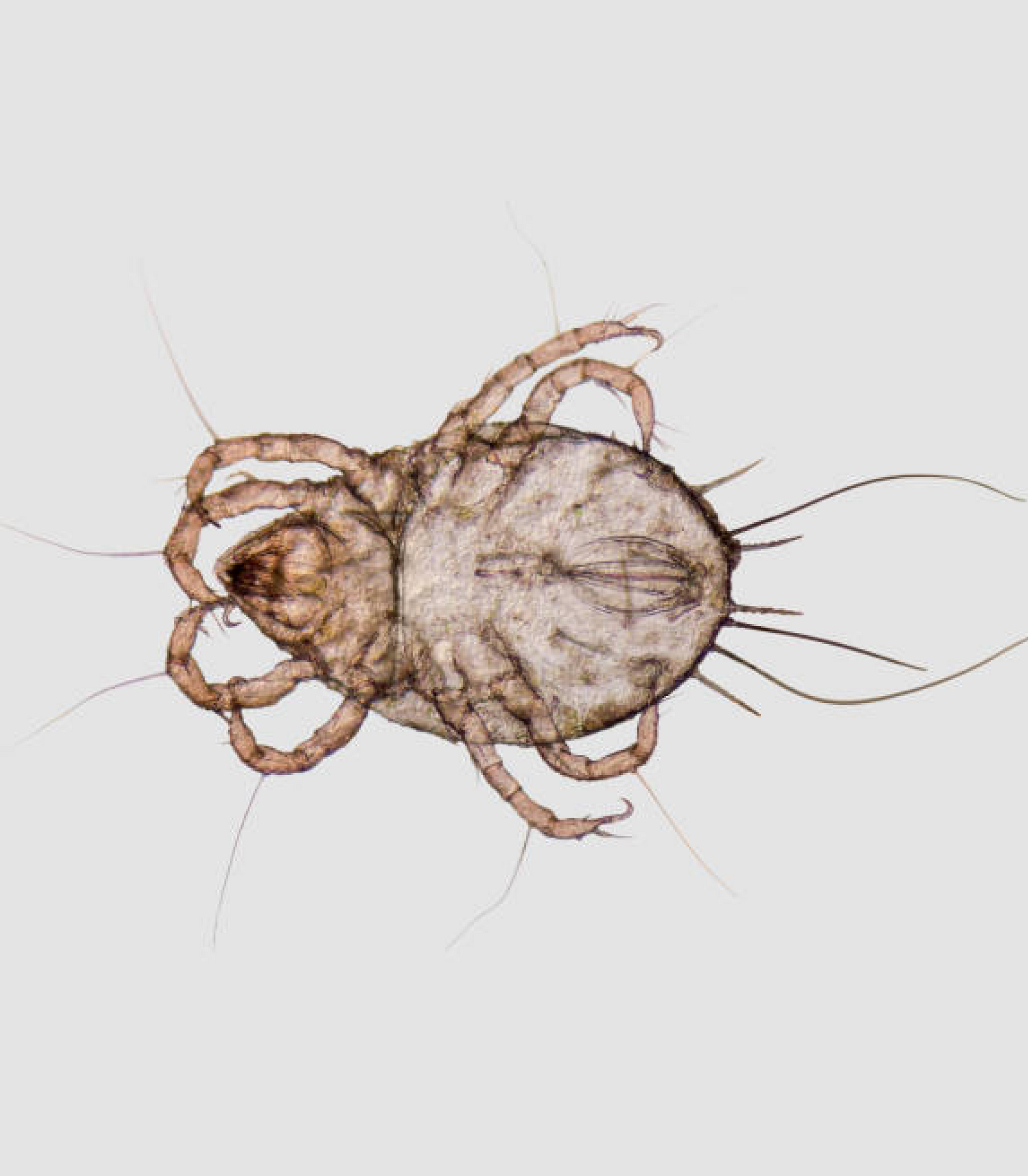 I Think I Have a Dust Mite Allergy. What Should I Do? - Allermi